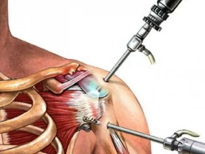 artroskopiya-top-1140x800-min.jpg